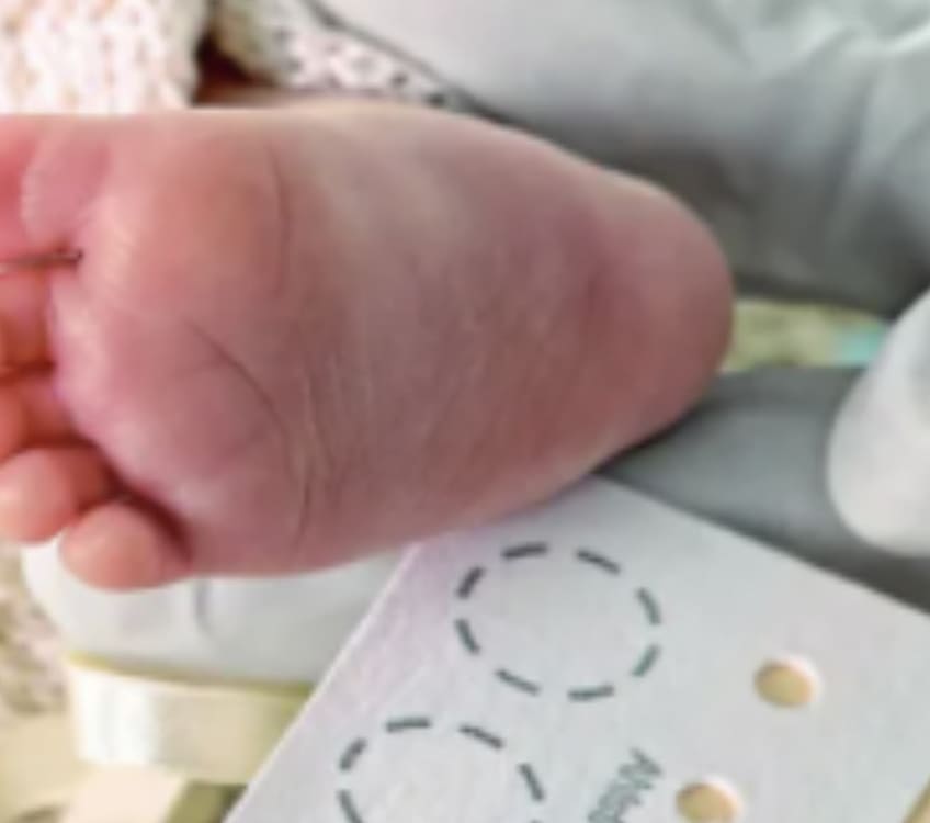 Tamiz de Neurodesarrollo